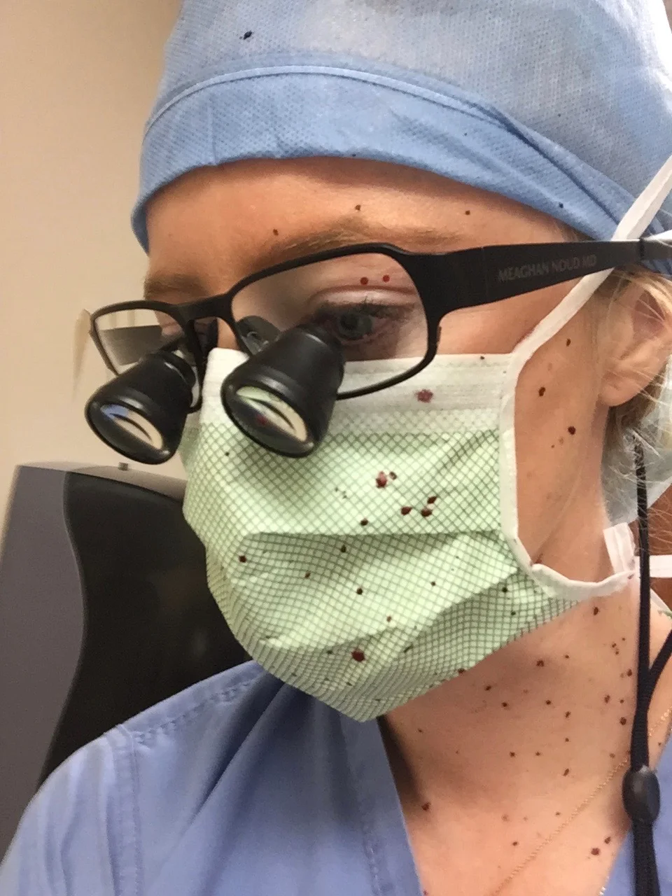 A close-up "in the trenches" photo of Dr. Noud wearing surgical loupes and a mask speckled with minor surgical splatter, showcasing the reality of a busy day in the OR.