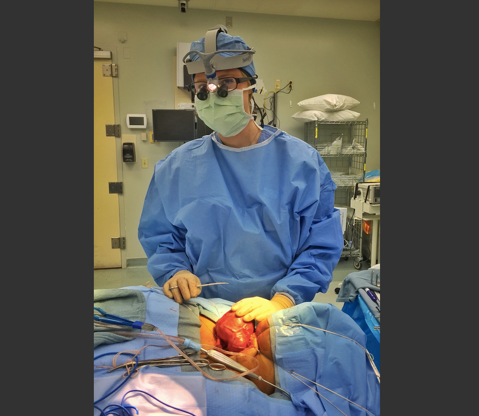 Real plastic surgery patient before and after results by Dr. Meaghan Noud in San Francisco, CA.