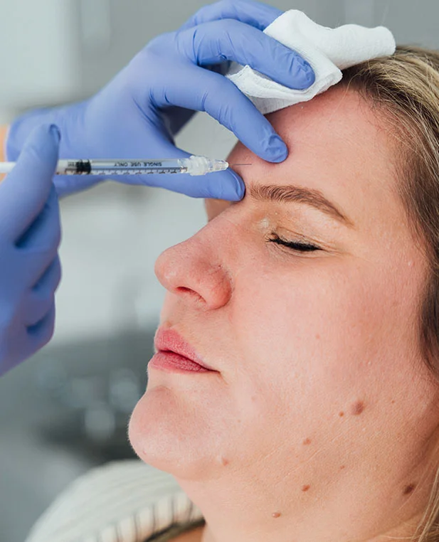 A close-up, profile view of a patient receiving a Botox injection. Dr. Noud, wearing blue medical gloves, carefully administers the treatment into the patient’s forehead using a fine-tip syringe.