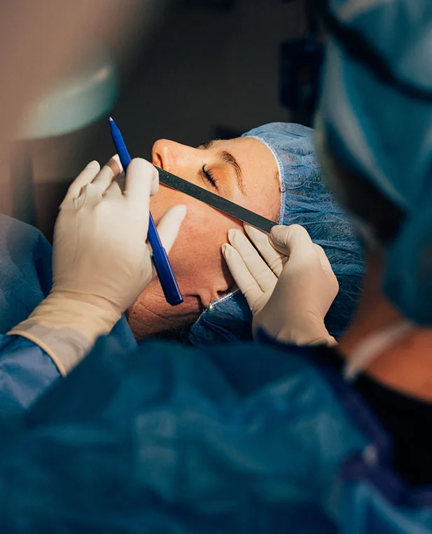 Dr. Noud performs upper eyelid surgery, using a metal gauge and a blue marking pen to precisely measure and mark the incision area on a patient in the operating room.