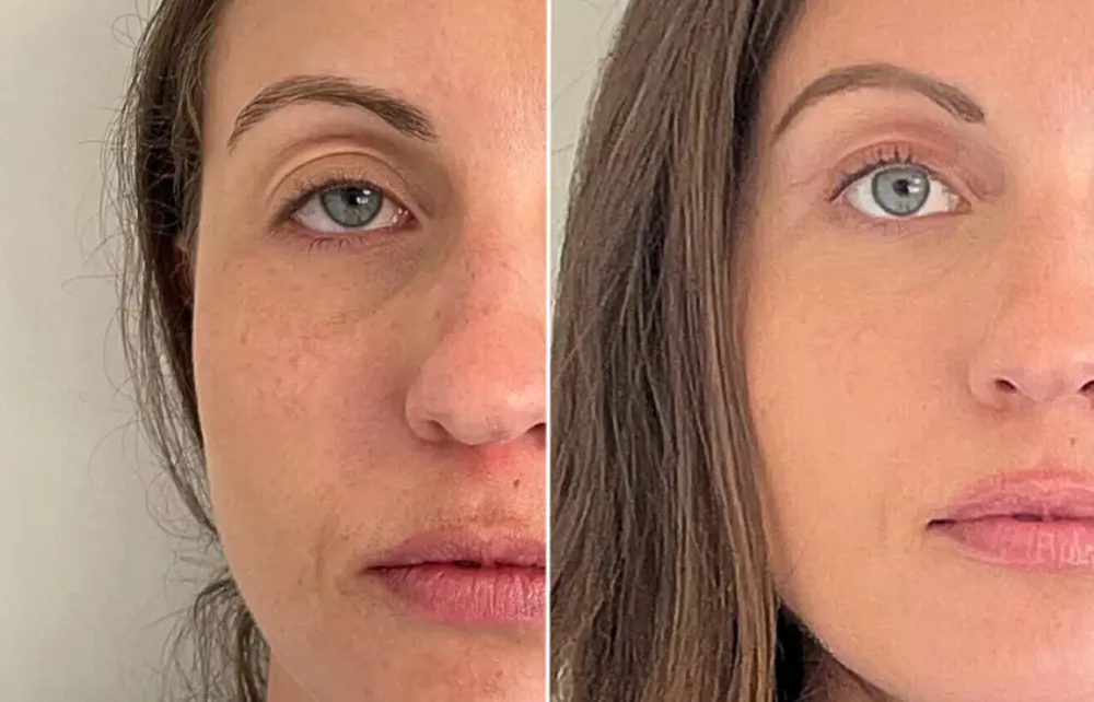 Home page priority 3