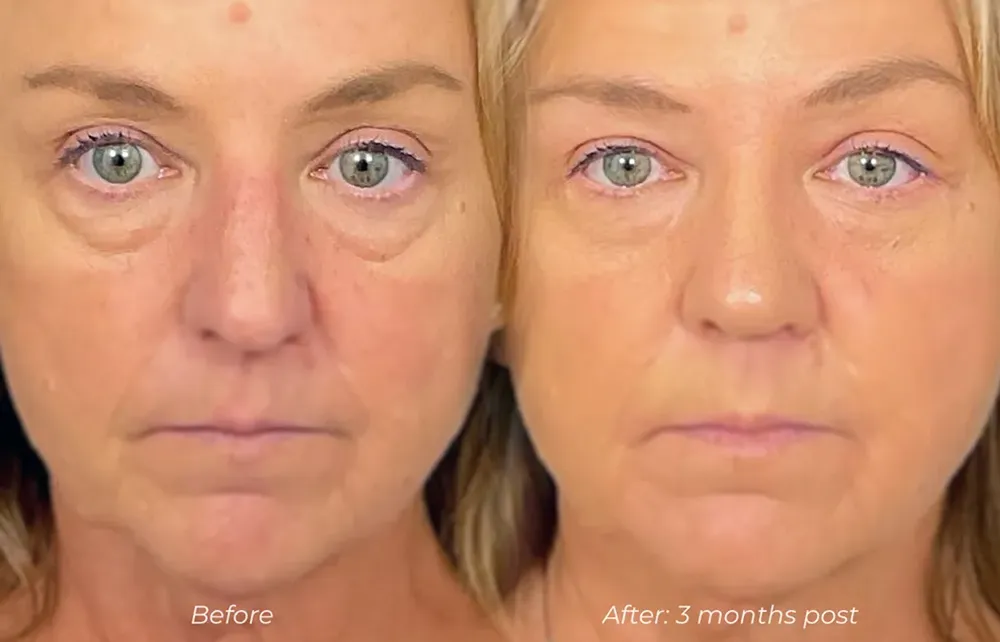 Home page priority 5