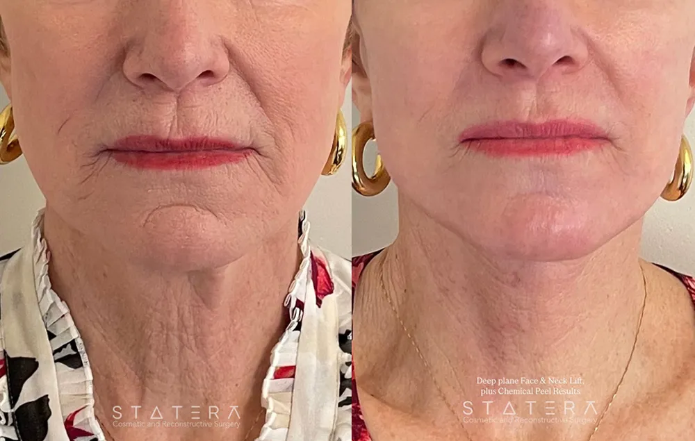 Home page priority 6