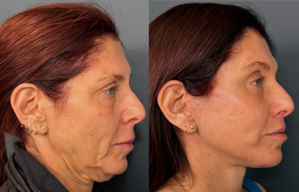 Untitled design (22)