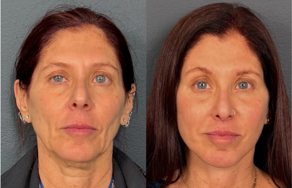 Untitled design (23)